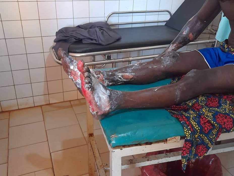Crime horrible à Kouroussa : un jeune brûlé vif dans la localité de Norombo, la famille sollicite SOS…