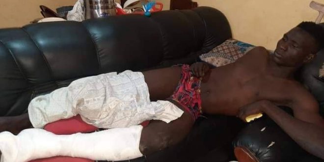 Guinée : Renversé par le cortège du Président du CNT, Mohamed Bangoura risque de perdre l’usage de ses pieds